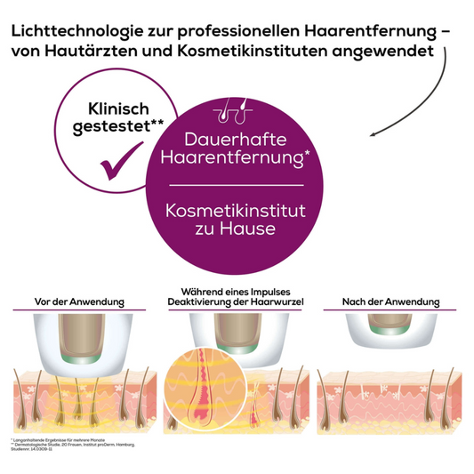 Eine deutsche Infografik zur Haarentfernungstechnologie mit der Beurer Dauerhafte Haarentfernung IPL VelvetSkinPro Black veranschaulicht den Vorgang vor, während und nach der Anwendung. Der Text betont die professionelle Dauerhafte Haarentfernung für den Heimgebrauch, getestet von Hautärzten und Kosmetikinstituten. Die Abbildungen zeigen die Haarentfernung.