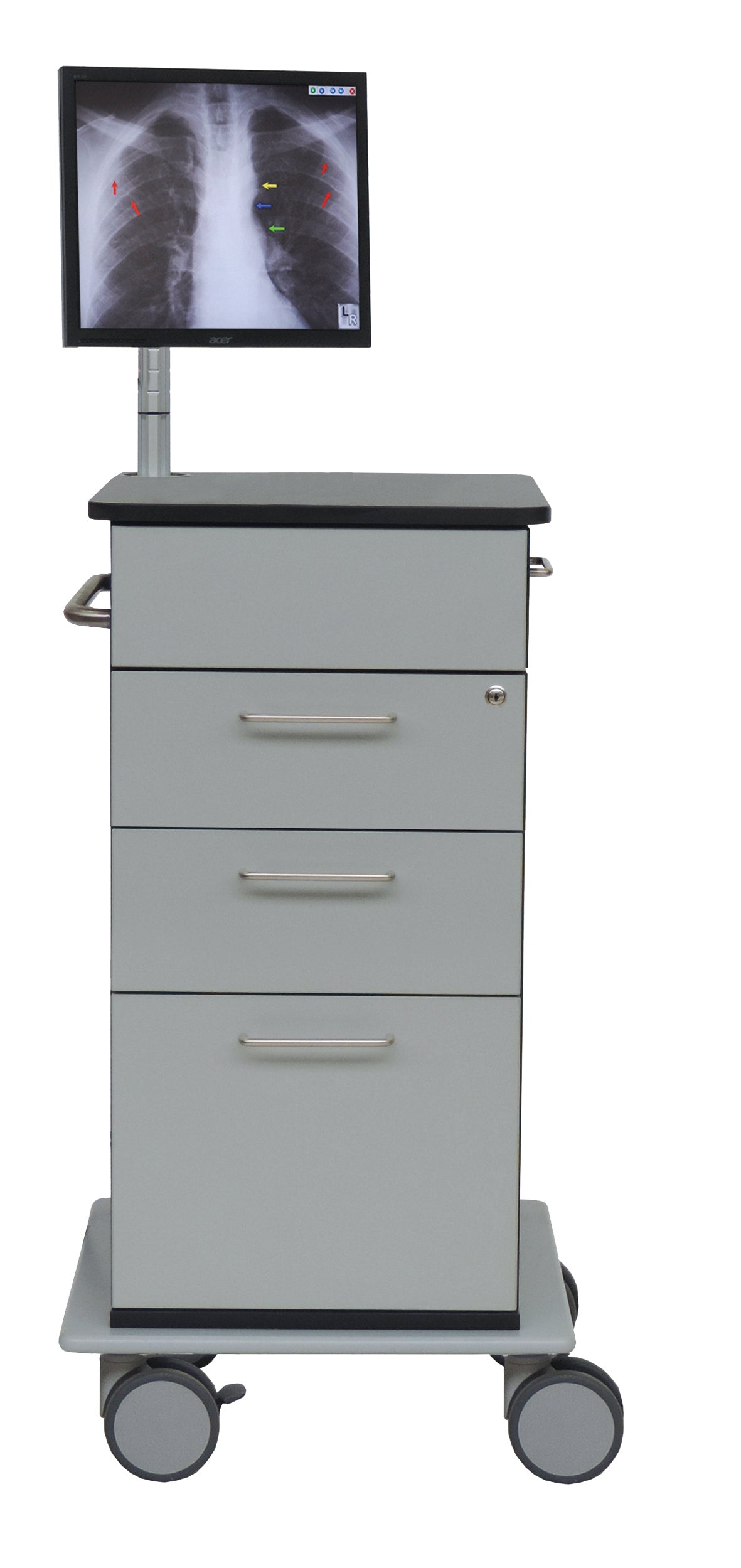 Abgebildet ist ein Novocal Computerwagen Modell I | Packung (1 Stück) mit einem rechts ausziehbaren Tastaturauszug und Mausfach. Er hat drei Schubladen, vier Räder, Metallgriffe und einen Monitor auf der Oberseite, der ein Röntgenbild der Brust anzeigt.