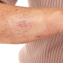Leukomed T Skin Sensitive, Sterile Transparent Bandage – In Use